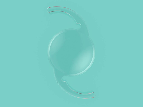 іонова внутрішньоочна лінза катарактальна офтальмологія
  - Фото, зображення