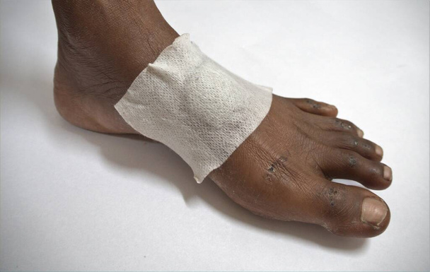 Füße einer Person mit einer Wunde nach einem Unfall - Foto, Bild