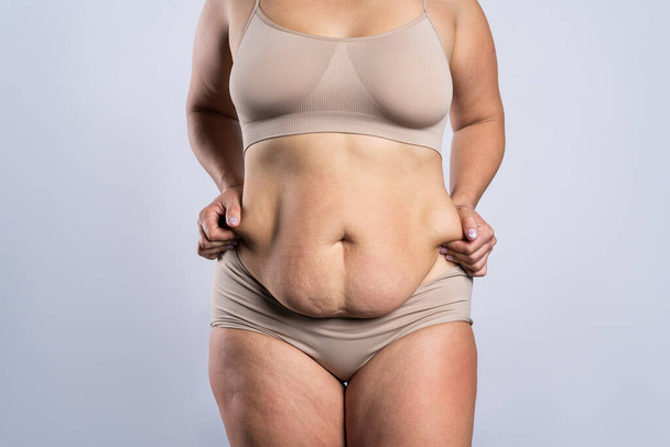 Tummy tuck, flabby skin on a fat belly, plastic surgery concept on gray background - Foto, Bild