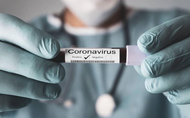 Positives Ergebnis des Coronavirus-Tests Covid-19. Arzt zeigt das Ergebnis einer Blutuntersuchung. Neuartiges Coronavirus-Konzept 2019. - Foto, Bild