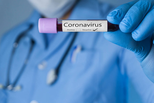 El médico está mostrando una muestra de análisis de sangre con coronavirus negativo. Concepto Covid-19. - Foto, imagen