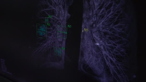 der Arzt schaut auf den Monitor Fluorographie der Lungen - Filmmaterial, Video