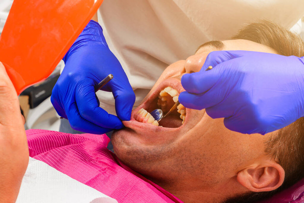 Pacjent u dentysty, mężczyzna trzyma lustro w rękach, ocenia stan zęba.2020 - Zdjęcie, obraz