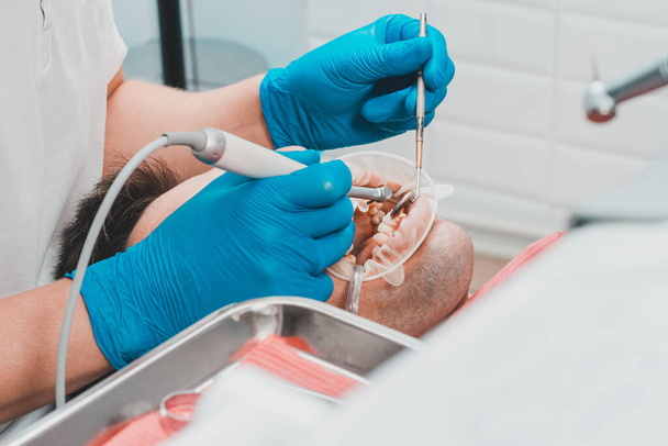 pacjent usuwający tatuaż, stomatolog używa ultradźwięków do usuwania tatuaży, skalera dentystyczna.2020 - Zdjęcie, obraz