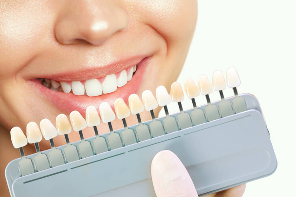 Χαμογελαστή νεαρή γυναίκα. Καλλυντικά λεύκανση δοντιών σε οδοντιατρική κλινική. επιλογή του τόνου του δοντιού εμφύτευσης - Φωτογραφία, εικόνα