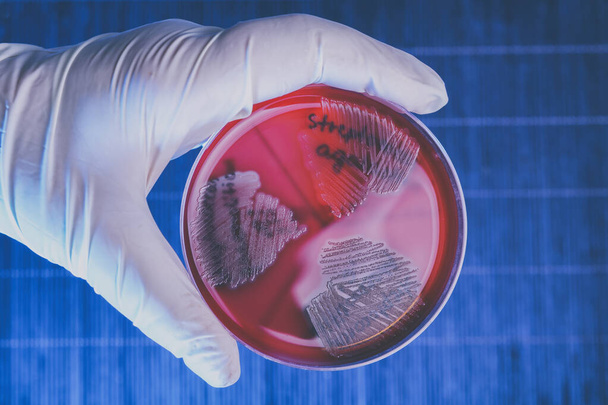 Рука об перчатку держит чашку Петри с бактериями Steptococcus Phaemolifticus G, Streptococcus Agalactiae, Streptococcus Phaemolifticus - Фото, изображение