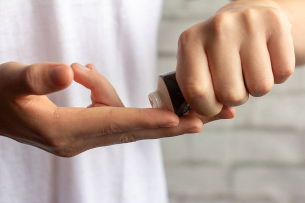 Les mains d'un adolescent pressent une crème pour soigner les problèmes de peau. - Photo, image