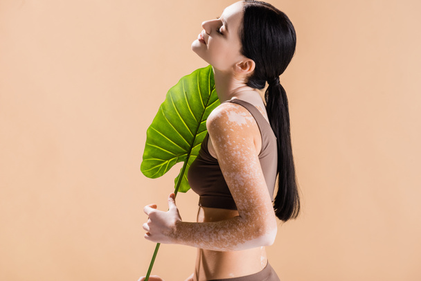 side view of smiling young beautiful woman with vitiligo posing with green leaf isolated on beige - Zdjęcie, obraz