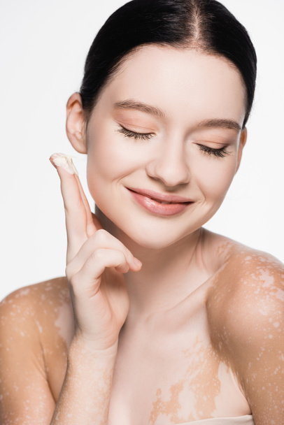 lächelnde junge schöne Frau mit Vitiligo Anwendung kosmetischer Creme isoliert auf weiß - Foto, Bild