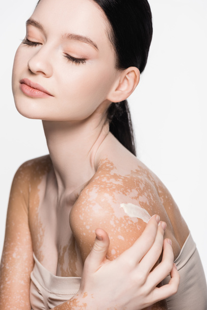 young beautiful woman with vitiligo applying cosmetic cream on shoulder isolated on white - Zdjęcie, obraz