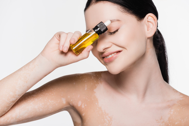 smiling young beautiful woman with vitiligo holding essential oil isolated on white - 写真・画像