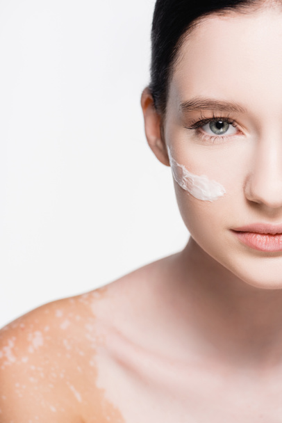 abgeschnittene Ansicht der jungen schönen Frau mit Vitiligo und Gesichtscreme auf der Wange isoliert auf weiß - Foto, Bild