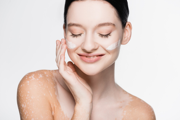 улыбающаяся молодая красивая женщина с витилиго и кремом для лица на щеках изолированы на белом - Фото, изображение