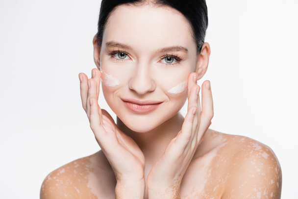 sonriente joven hermosa mujer con vitiligo y crema facial en las mejillas aisladas en blanco - Foto, Imagen