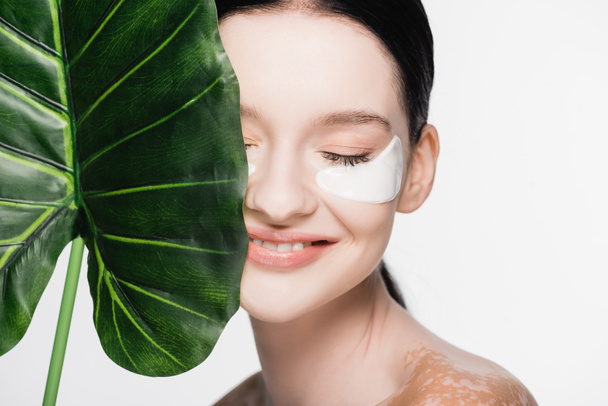 sonriente joven hermosa mujer con vitiligo y parches en los ojos en la cara cerca de hoja verde aislado en blanco - Foto, Imagen