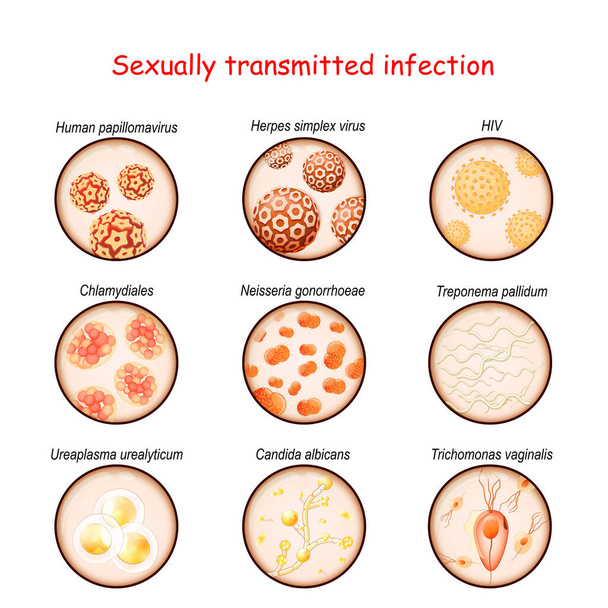 Seksueel overdraagbare infectie. Close-up van de veroorzakers van de enereale ziekte: Ureaplasma, Trichomonas, Candida, Treponema, Chlamydiales, Neisseria gonorrhoeae, Herpesvirus, HIV, papillomavirus - Vector, afbeelding