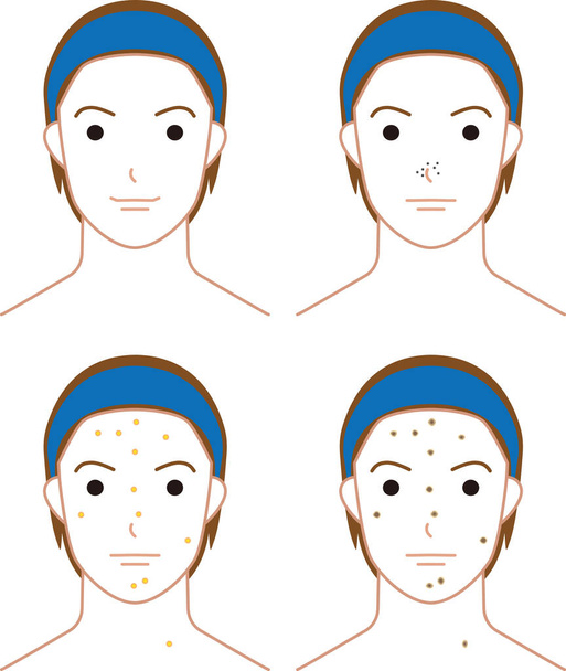 Rostro de un joven con acné - Vector, Imagen