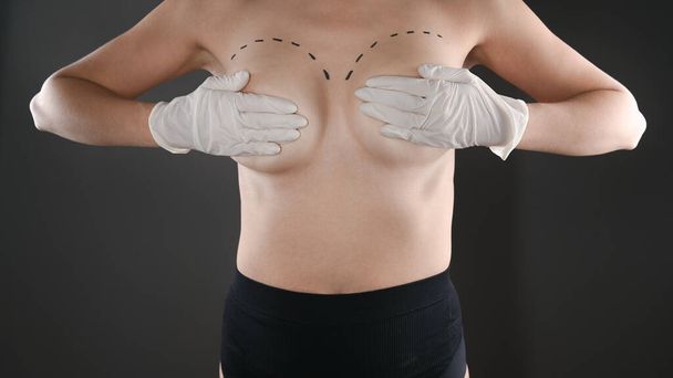 Chirurgia powiększenia piersi, koncepcja powiększenia piersi. Wysokiej jakości zdjęcie - Zdjęcie, obraz