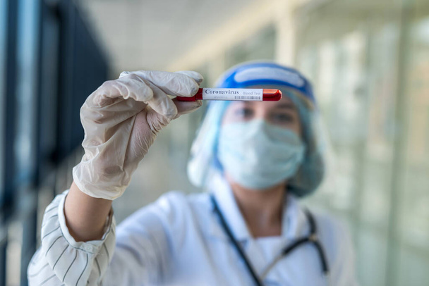  estudiante de prácticas femeninas observa un tubo de ensayo de sangre en el laboratorio para determinar el coronavirus del virus. covid 19 - Foto, imagen