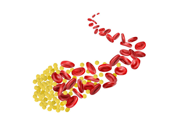 Le cholestérol arrête le flux des globules rouges - Vecteur, image