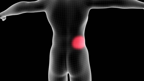 3D απεικόνιση ενός ολογράμματος ακτίνων Χ ανδρών δείχνει την περιοχή του πόνου στην πίσω περιοχή - Φωτογραφία, εικόνα