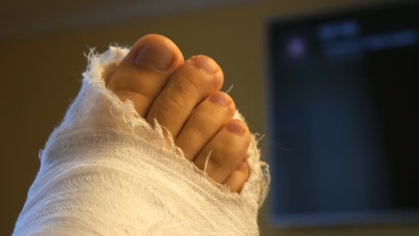 mannelijk been in een gips gips. tenen bewegen. Tegen de achtergrond van de TV, close-up. - Video