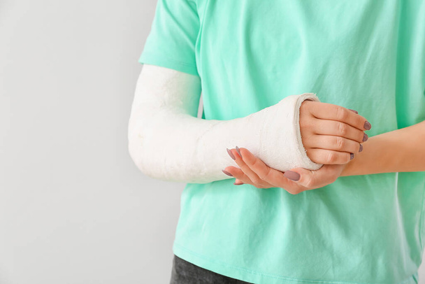 Young woman with broken arm on light background, closeup - Photo, Image