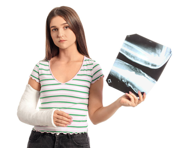 Młoda kobieta ze złamaną ręką trzymająca zdjęcie rentgenowskie na białym tle - Zdjęcie, obraz