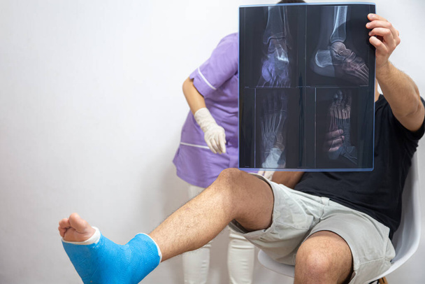 La dottoressa in abito blu spiega a un paziente di sesso maschile con una gamba rotta il risultato di una radiografia. - Foto, immagini