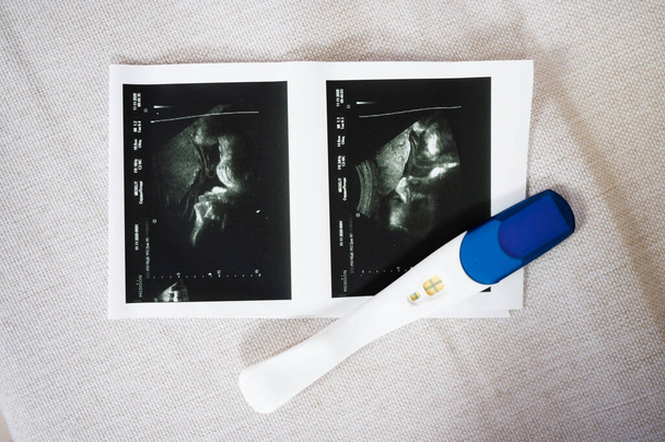 Рентген ребенка в животе матери. Высокое качество фото - Фото, изображение