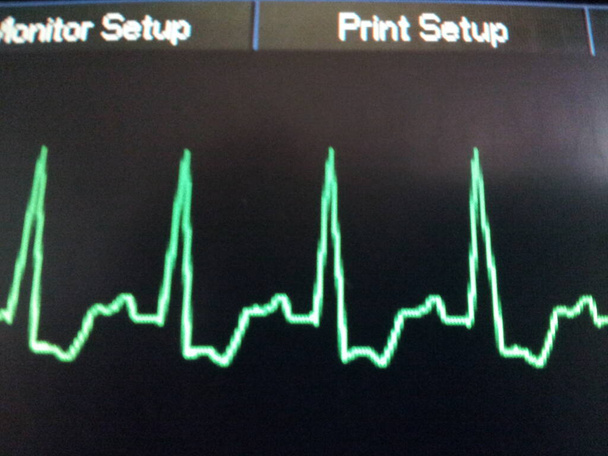 EKG Green Wave Tracing on ICU Monitor - Photo, Image