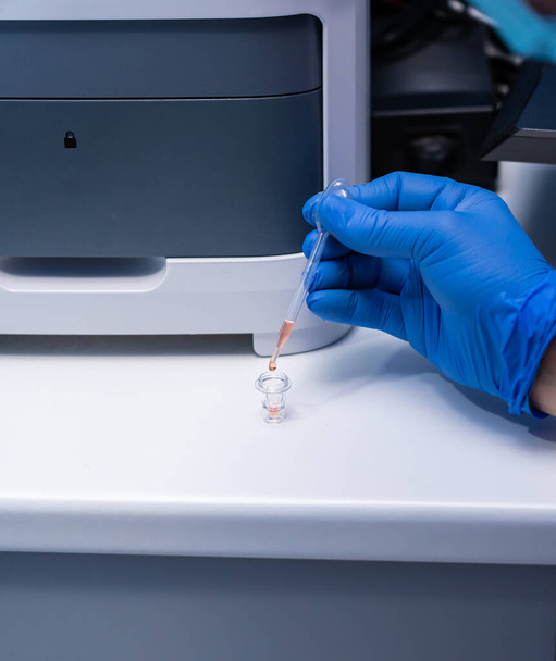 Preparazione del siero di sangue per l'analisi in una macchina biochimica - Foto, immagini