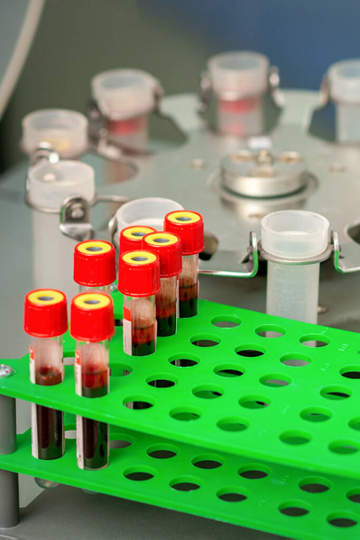 Δοκιμαστικοί σωλήνες με δείγματα αίματος σε σχάρα και σε μηχανή φυγοκέντρησης στο εργαστήριο - Φωτογραφία, εικόνα