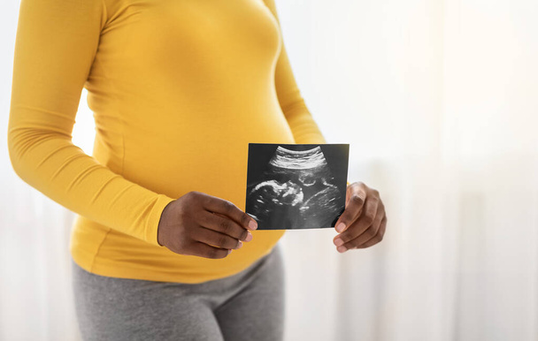 Mujer embarazada irreconocible que sostiene la imagen de ultrasonido del feto - Foto, imagen