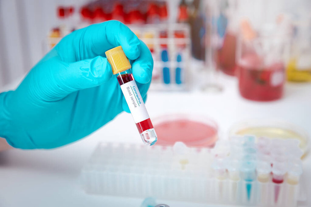 Исследователи проверяют образцы крови в лаборатории. Исследователи изобретают вакцины для лечения вируса COVID-19. - Фото, изображение