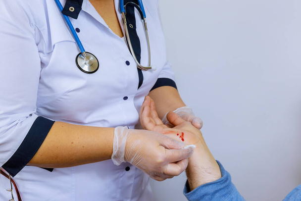 Hand gewond van verse wond met bloed patiënt op bezoek arts traumatoloog - Foto, afbeelding