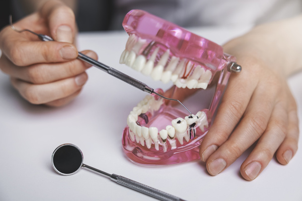 dentista que muestra caries dental caries dental en modelo de mandíbula - Foto, Imagen
