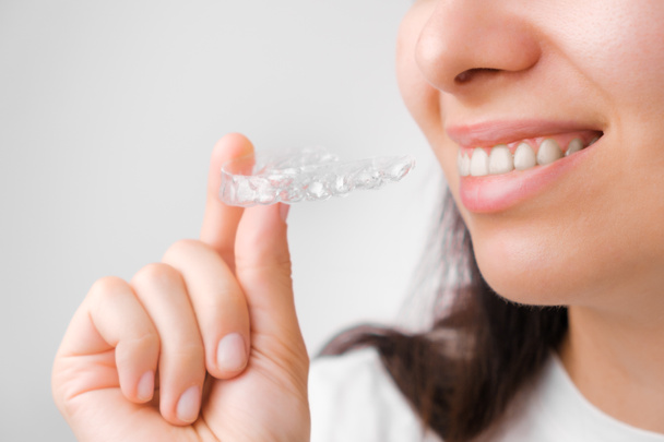 Close up de uma jovem mulher ajustando alinhadores transparentes. A tratar dos dentes. Tratamento ortodôntico para alisamento e clareamento dos dentes.  - Foto, Imagem