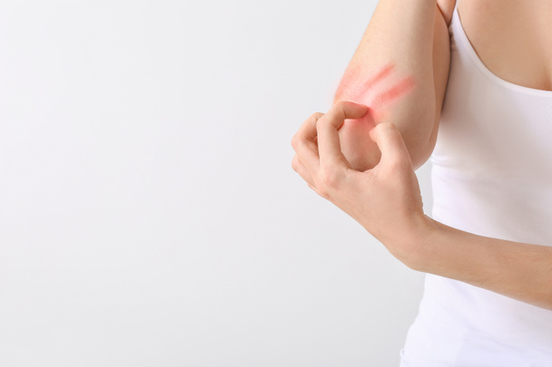 Mujer alérgica joven rascarse la piel contra fondo claro, primer plano - Foto, Imagen