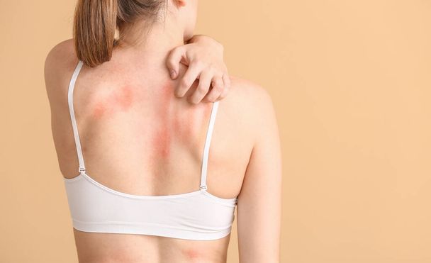 Young allergic woman scratching her skin against color background - Photo, Image
