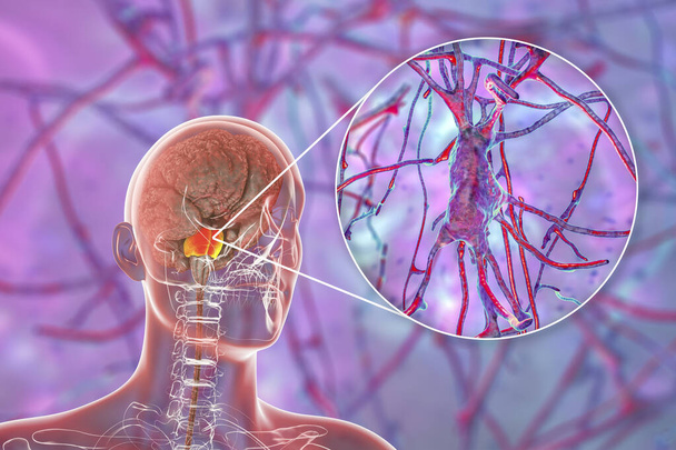 Ludzki mózg z podkreślonymi ponami Varolii i widok z bliska piramidalnych neuronów znajdujących się w polach, ilustracja 3D - Zdjęcie, obraz