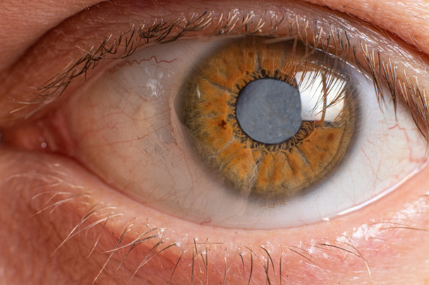 人間の目のマクロ写真-レンズの白内障の雲、視力の悪化。治療、手術、眼科 - 写真・画像
