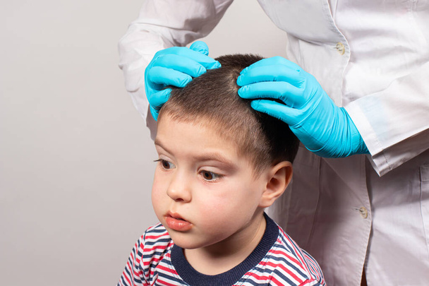 Der Kinderarzt in den Handschuhen überprüft das Vorhandensein von Läusen und Nissen bei einem kleinen Kind. Pedikulose im Kindergarten, Vorsorgeuntersuchung von Kopf und Haaren - Foto, Bild