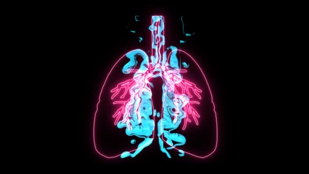 Pulmonary Edema in holographic digital lung, It is a symbol of suffocation which is very dangerous - Footage, Video