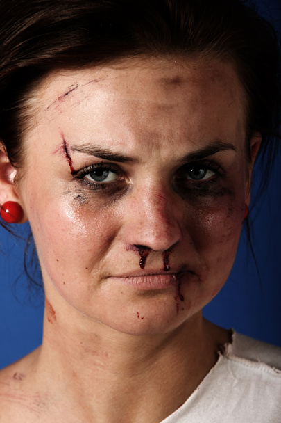 Mulher após lesão
 - Foto, Imagem