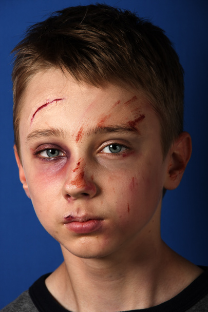 Verprügeltes Kind - Foto, Bild