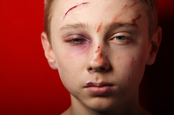 Beaten up kid - Photo, Image