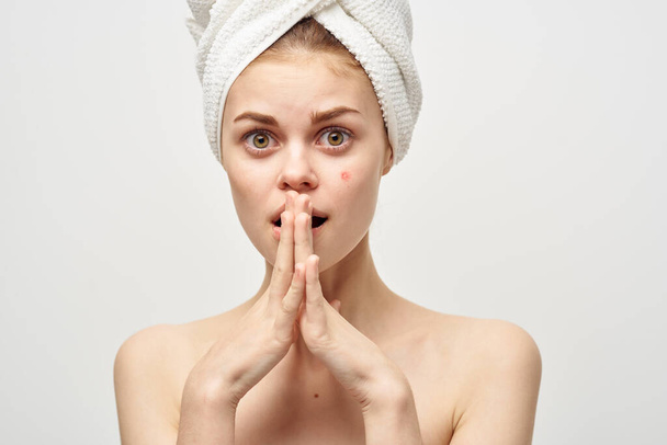 femme avec serviette sur la tête épaules nues soins spa acné peau claire - Photo, image