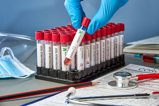 Тестовая трубка в руке с отрицательными образцами крови для COVID-19 рядом с короновирусной тестовой формой. Анализ крови на наличие антител к возбудителю новой коронавирусной инфекции - Фото, изображение