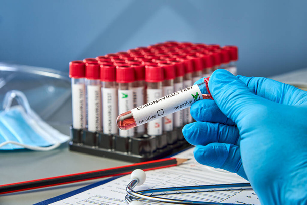 A test tube in your hand with negative blood samples for COVID-19 next to the coronovirus test form. Blood testing for the presence of antibodies to the causative agent of a new coronavirus infection - Fotó, kép